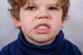 Malocclusion of the boy Royalty Free Stock Photo