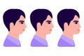 Malocclusion, man in profile. Wrong bite: lower jaw extended forward and retracted. Bite correction with braces. Vector