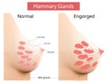 Mammary gland, Non-Lactating and Engorged breast, Female breast Anatomy, Vector