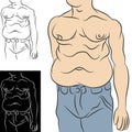 Man With Abdominal Fat Royalty Free Stock Photo