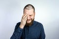 Man with alopecia on head, cry. Spot Baldness, Hair fall problem Royalty Free Stock Photo