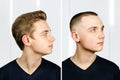 Man before arter haircut with hair loss: bald and pompadour, transplant and transformation in profile fade side