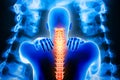 Man back body with spine and x-ray vertebrae imagery in the background. Neck pain or cervicalgia, backbone or cervical injury 3d Royalty Free Stock Photo