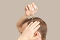 Man baldness treatment. Nature hair care Royalty Free Stock Photo