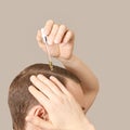 Man baldness treatment. Nature hair care Royalty Free Stock Photo