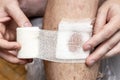 Man bandaging yourself bleeding wound on his leg