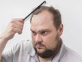 Man with a beard combs his hair in front of a mirror. A large bald spot on the forehead. The problem of hair loss. Scalp care