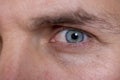 Man with blue eyes and a corrective contact lens. Royalty Free Stock Photo