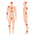 Man body with pain points. Circle painful red spot point on human silhouette vector medical abstract illustration