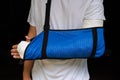 Man with broken arm wrapped medical cast plaster and blue bandage. Fiberglass cast covering the wrist, arm, elbow after sport Royalty Free Stock Photo