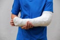 Man with broken arm wrapped medical cast plaster. Fiberglass cast covering the wrist, arm, elbow after sport accident, isolated on Royalty Free Stock Photo