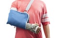 Man with broken bone arm using cast and sling for treatment