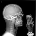 Man and cellphone under x-ray