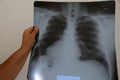 Man chest x-ray Royalty Free Stock Photo