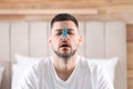 Man with clothespin suffering from runny nose