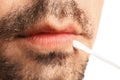 Man with cold sore applying cream on lips against white background, closeup Royalty Free Stock Photo