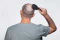 A man combs his bald head. Rear view. The concept of baldness and male alopecia Royalty Free Stock Photo