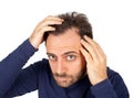 Man controls hair loss Royalty Free Stock Photo