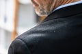 Man Dandruff On Suit Shoulder Royalty Free Stock Photo