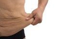 Man with fat belly and stretch marks isolated