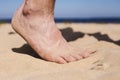 Man goes on the beach and the risk of stepping on a splinter of broken bottle glass Royalty Free Stock Photo