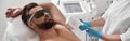 Man with goggles and bare chest undergoes procedure of arm pit laser epilation in clinic Royalty Free Stock Photo