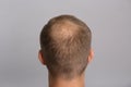 Man with hair loss problem on grey background, back view. Trichology treatment Royalty Free Stock Photo