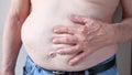 Man with hand over his overweight belly