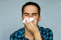 The man has a runny nose Royalty Free Stock Photo