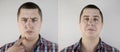 Man has a second chin. Photos before and after plastic surgery of the face. Close-up of a patient`s sad face and his fat on