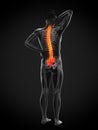 A man having acute back pain