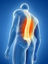 A man having back pain