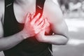 Man having chest pain while exercising - heart attack outdoor. or Heavy exercise causes the body to shock heart disease.