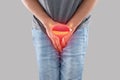 Cystitis symptoms with men