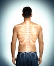 Man with healthy back on background. Spine pain prevention Royalty Free Stock Photo