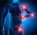 Man with heavy joint pain symptoms