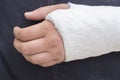 Man with his broken arm. Arm in cast. Royalty Free Stock Photo