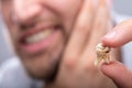 Man Holding Decayed Tooth