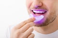 A man holds in his hand an ultraviolet lamp for home teeth whitening. A snow-white smile after bleaching.