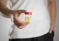 A man holds a jar with a urine test. Close up Royalty Free Stock Photo