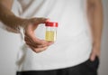 A man holds a jar with a urine test. Close up