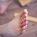 A man injured his leg falling from a broken ladder, foot close-up. Problems with labor protection when working at home Royalty Free Stock Photo