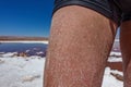 Man leg with salt after swimming in Atacama salt lakes