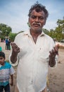 Man with leprosy residing in a rehabilitation centre in Andhra Pradesh, India