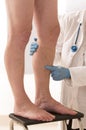 Man Lower limb vascular examination by phlebologist