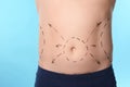 Man with marks on belly for cosmetic surgery operation against blue background