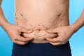 Man with marks on belly for cosmetic surgery operation against blue background