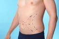 Man with marks on belly for cosmetic surgery operation against blue background