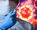 Man in a mask and protective gloves on the background of the image of a coronavirus. Doctor with a vaccine and a syringe