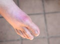 Man with painful gout inflammation on big toe joint. Royalty Free Stock Photo